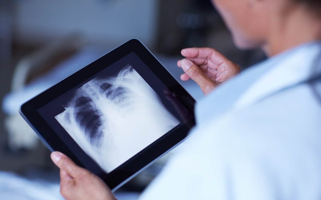 doctor holding an x-ray